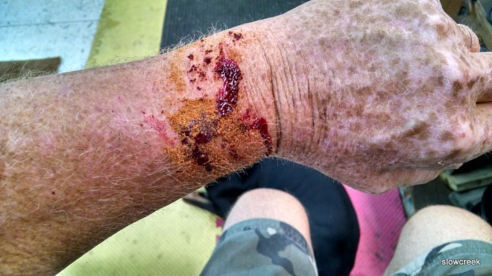 Safety and Emergency Preparedness when working on your Jeep-cayenne-wound.jpg